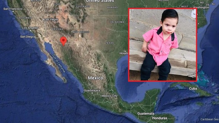 Meksyk. Dwulatek połknął baterię. Lekarze walczą o jego życie
