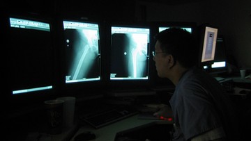 W radomskim szpitalu może zabraknąć radiologów