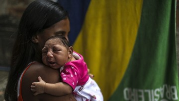 Wirus Zika wywołuje mikrocefalię u niemowląt