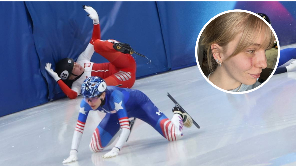 Zawodniczka short track Sellier z widoczną blizną na twarzy po wypadku.