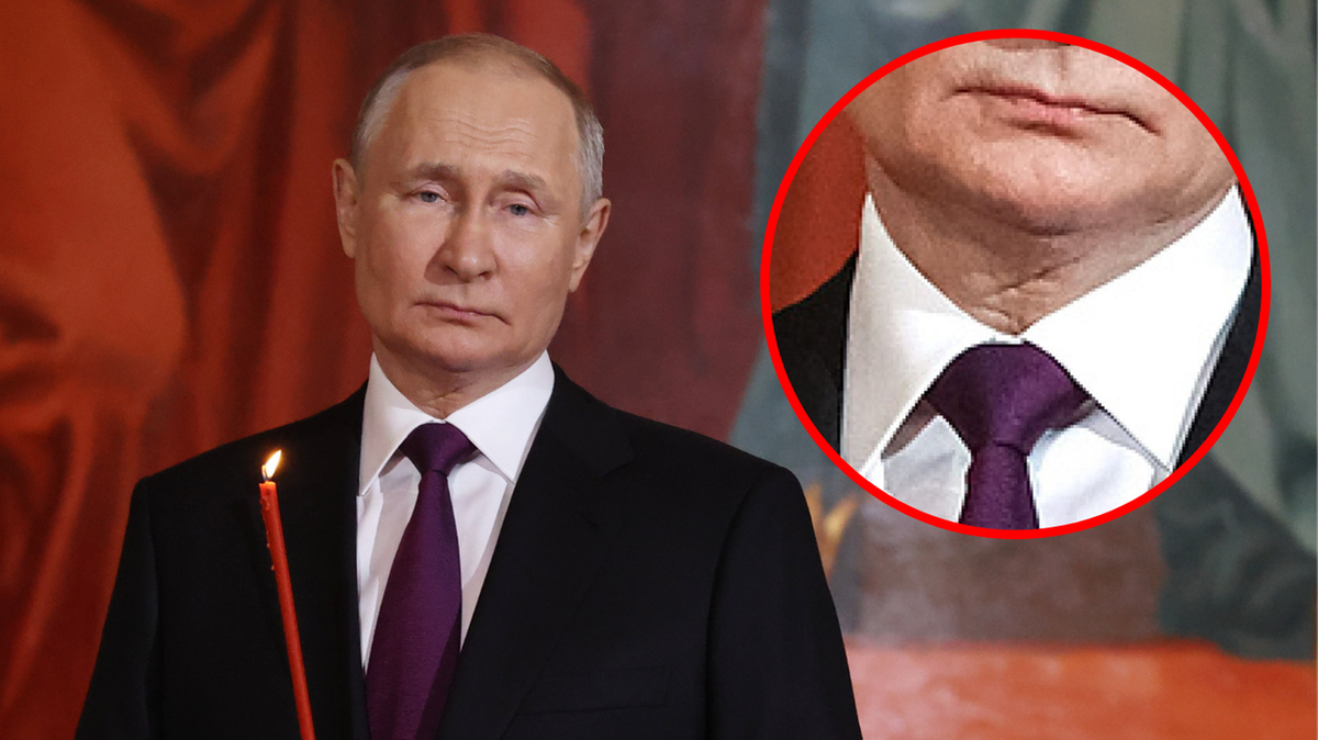 Na szyi Putina zauważono tajemniczą "bliznę". Przywódca Rosjan przeszedł operację?