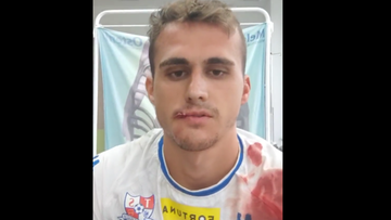 Fortuna 1 Liga: Znamy stan zdrowia przebywającego w szpitalu piłkarza Podbeskidzia