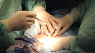 Pacjentowi zaszyto w brzuchu dwie serwety chirurgiczne podczas operacji. Sąd uniewinnił lekarza