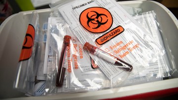 Zły efekt lockdownu. Epidemiolodzy mają inną strategię walki z pandemią